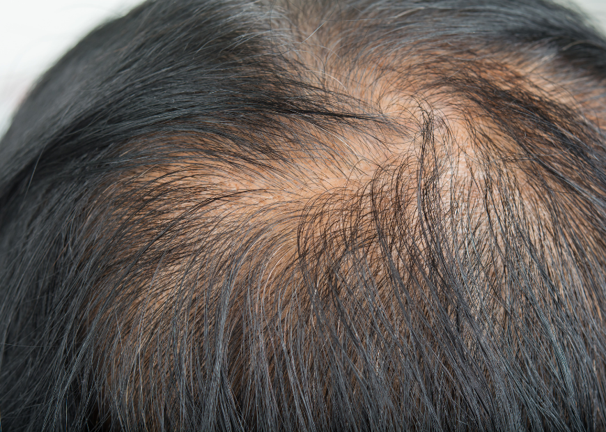 スカルプインクはこんな悩みの方におすすめ! bondzsalon